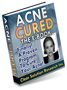 acne cure ebook large Acne cured the e book